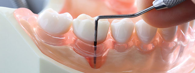 Paradontologie Alba - Aiud