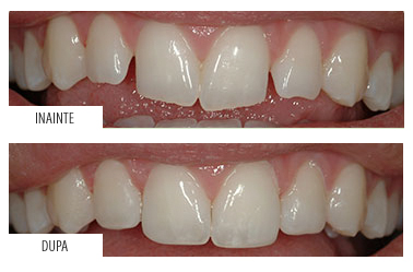Estetica Dentara Alba - Aiud