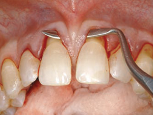 Chirurgie Orala Alba - Aiud