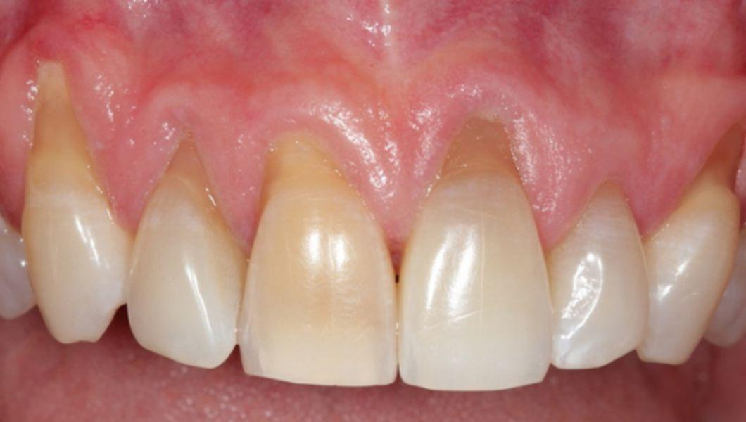 Chirurgie Orala Alba - Aiud