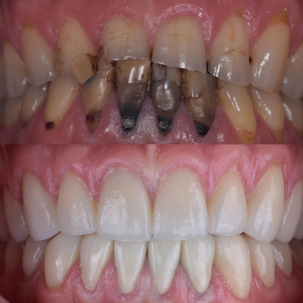Estetica Dentara Alba - Aiud