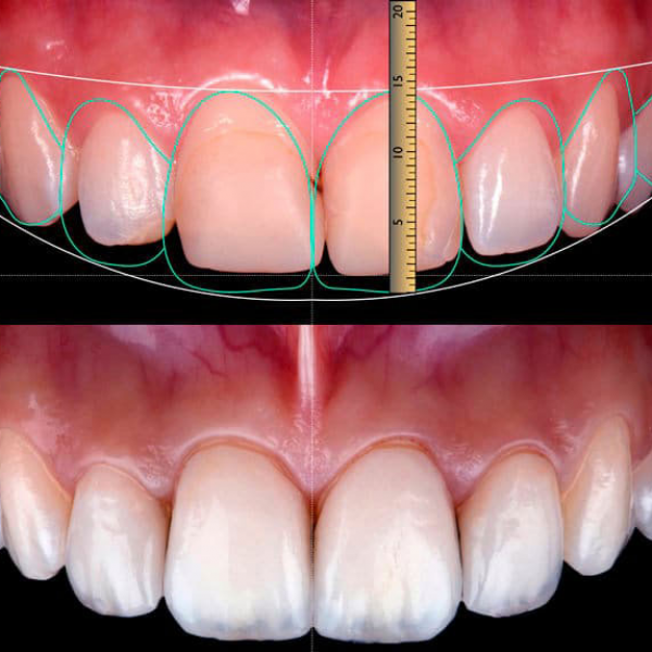Estetica Dentara Alba - Aiud