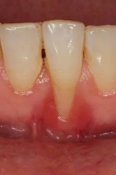 Chirurgie Orala Alba - Aiud