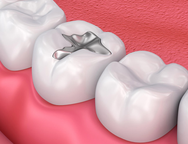 Terapia Cariilor Alba - Aiud